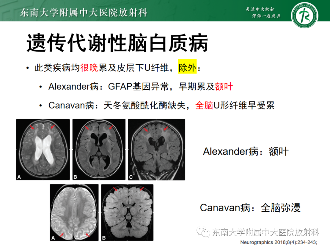 影像PPT - 【PPT】皮层下U形纤维受累常见病变-30
