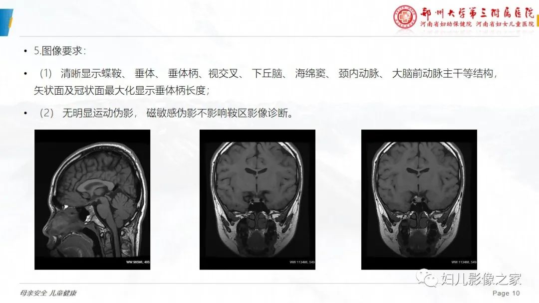 影像PPT - 【PPT】磁共振扫描技术专家共识解读-10