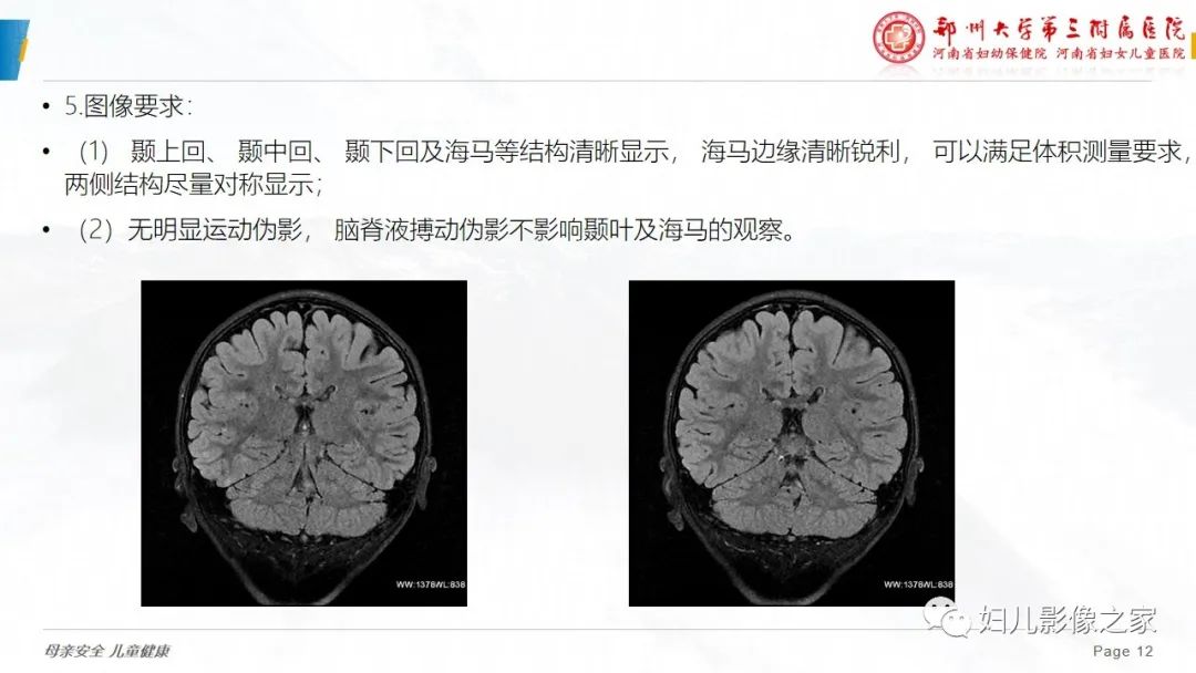 影像PPT - 【PPT】磁共振扫描技术专家共识解读-12