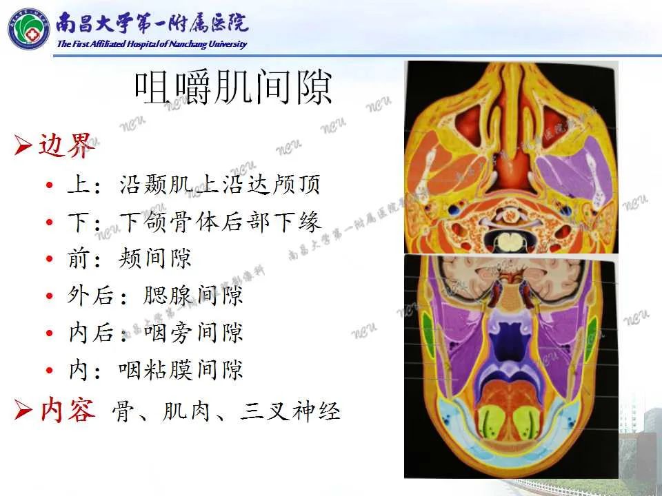 影像PPT - 【PPT】咽旁间隙——你别动-10