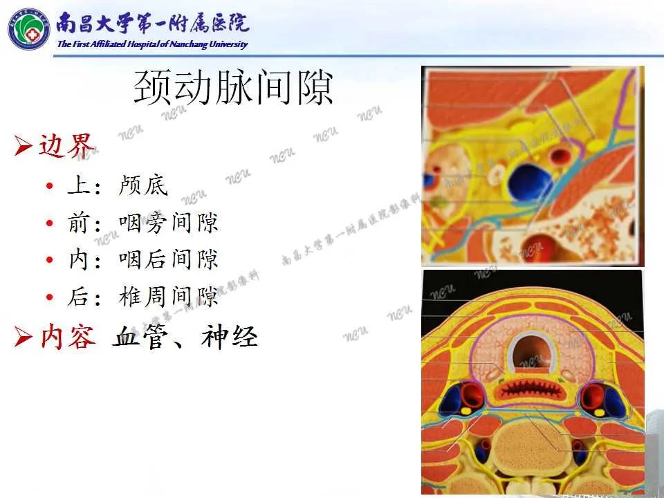 影像PPT - 【PPT】咽旁间隙——你别动-12