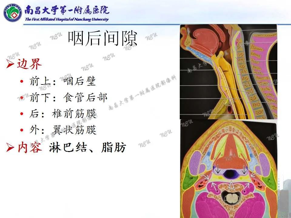 影像PPT - 【PPT】咽旁间隙——你别动-13