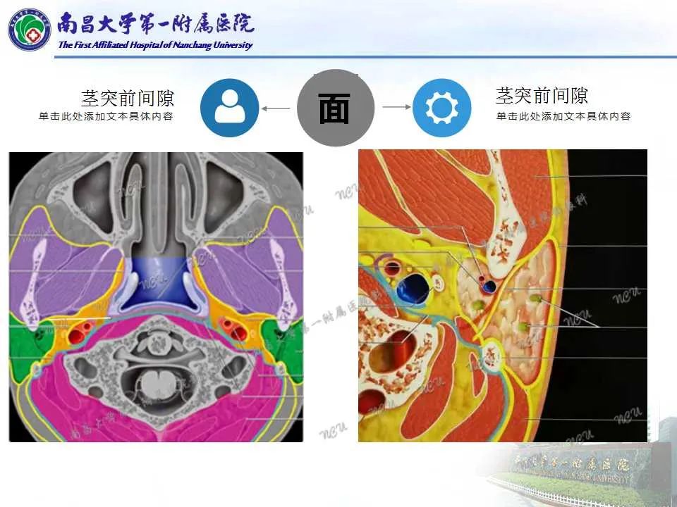 影像PPT - 【PPT】咽旁间隙——你别动-25