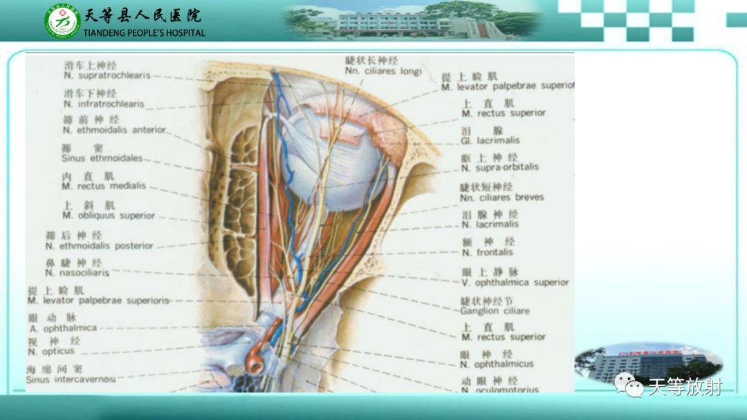 影像PPT - 【PPT】眼眶分区及各分区常见疾病-2