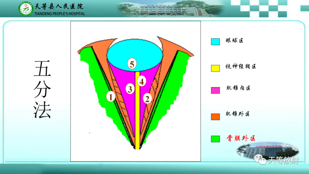 影像PPT - 【PPT】眼眶分区及各分区常见疾病-8