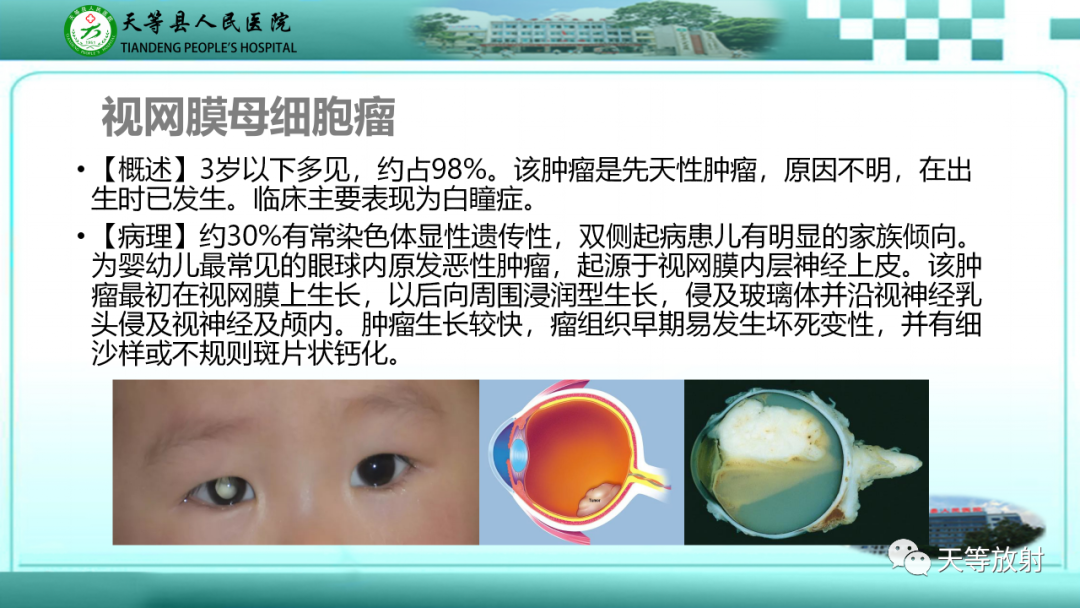 影像PPT - 【PPT】眼眶分区及各分区常见疾病-11