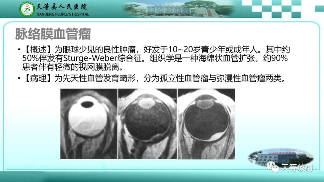 影像PPT - 【PPT】眼眶分区及各分区常见疾病-17