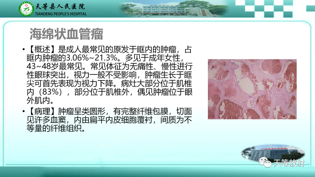 影像PPT - 【PPT】眼眶分区及各分区常见疾病-24