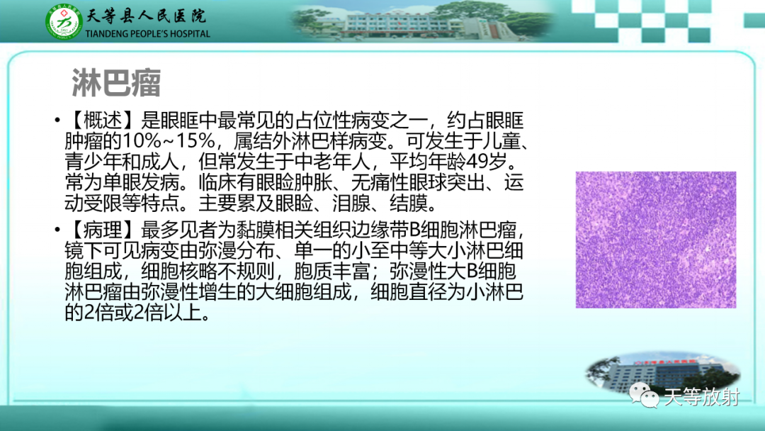 影像PPT - 【PPT】眼眶分区及各分区常见疾病-33