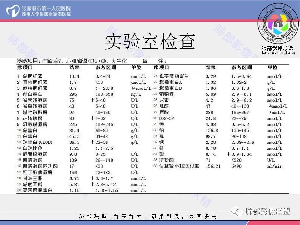 影像PPT - 【病例】一例肺胶样腺癌伴中心粗钙化灶CT-4 影像PPT - 【病例】一例肺胶样腺癌伴中心粗钙化灶CT-4