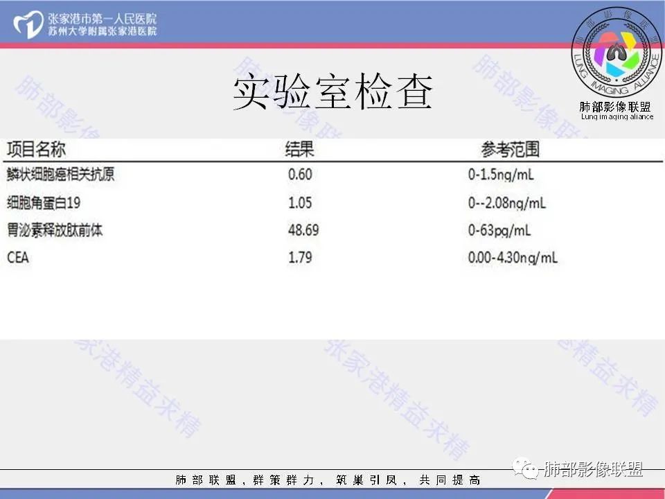 影像PPT - 【病例】一例肺胶样腺癌伴中心粗钙化灶CT-5 影像PPT - 【病例】一例肺胶样腺癌伴中心粗钙化灶CT-5