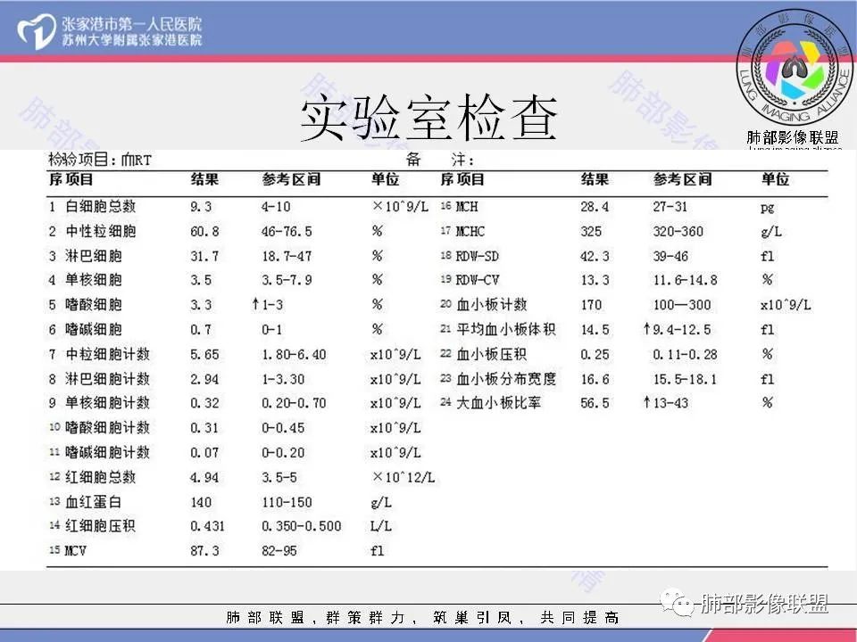 影像PPT - 【病例】一例肺胶样腺癌伴中心粗钙化灶CT-3 影像PPT - 【病例】一例肺胶样腺癌伴中心粗钙化灶CT-3