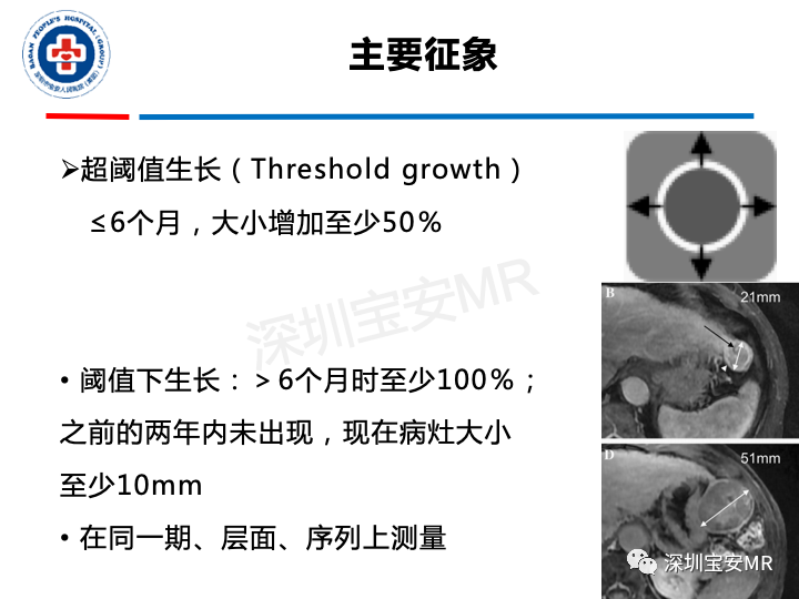 影像PPT - 【PPT】原发性肝癌影像检查-22