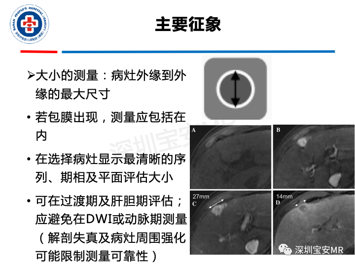 影像PPT - 【PPT】原发性肝癌影像检查-23