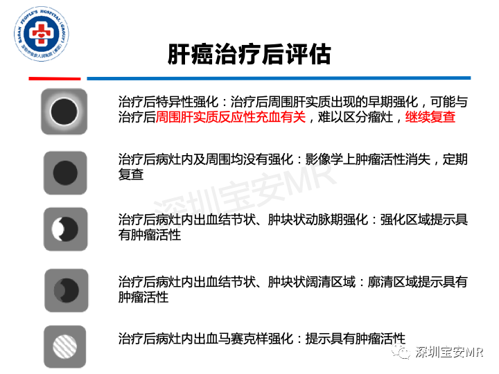 影像PPT - 【PPT】原发性肝癌影像检查-33