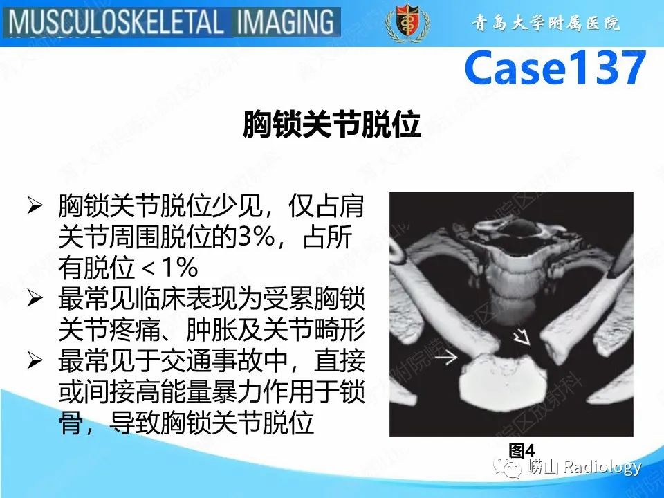 影像PPT - 【PPT】胸锁关节脱位-7