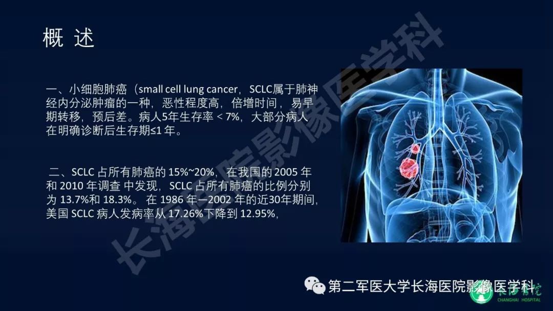 影像PPT - 【PPT】浅谈小细胞肺癌的影像诊断-2