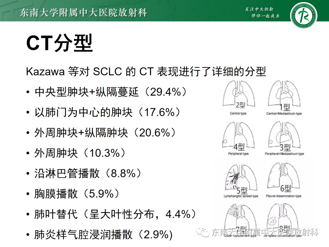 影像PPT - 【PPT】小细胞肺癌-12 影像PPT - 【PPT】小细胞肺癌-12