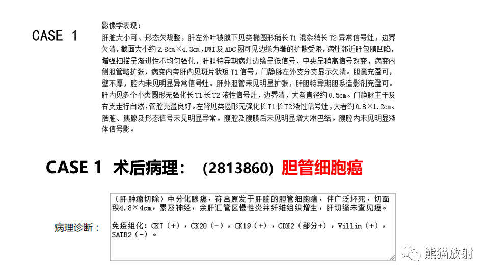 影像PPT - 【PPT】肝内胆管细胞癌 VS 肝脓肿-24