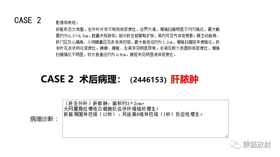 影像PPT - 【PPT】肝内胆管细胞癌 VS 肝脓肿-25