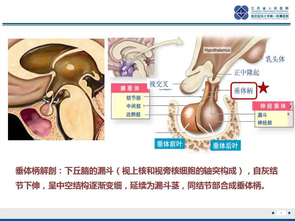 影像PPT - 【PPT】垂体细胞瘤-10