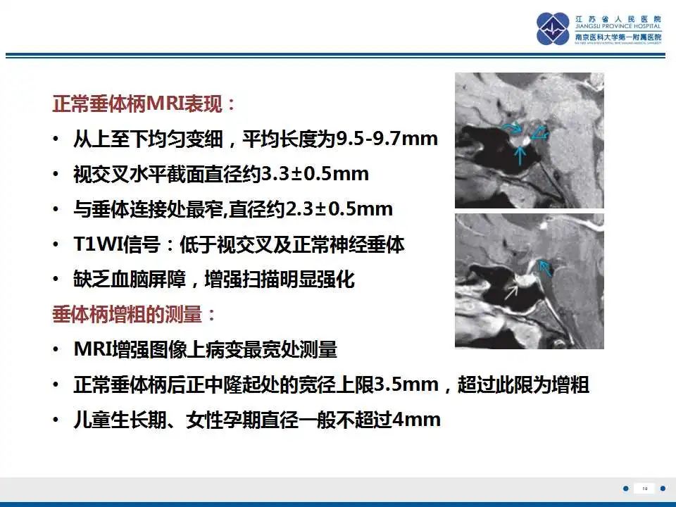 影像PPT - 【PPT】垂体细胞瘤-11