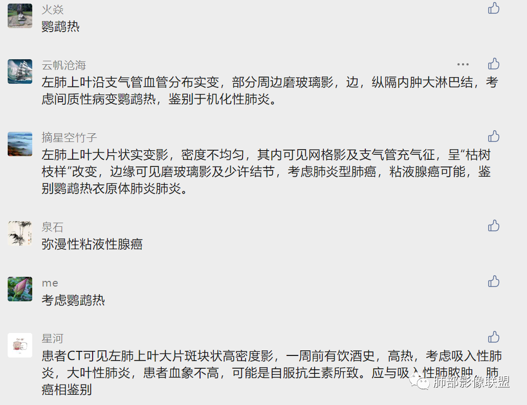 影像PPT - 【病例】鹦鹉热衣原体感染肺炎1例CT-22 影像PPT - 【病例】鹦鹉热衣原体感染肺炎1例CT-22