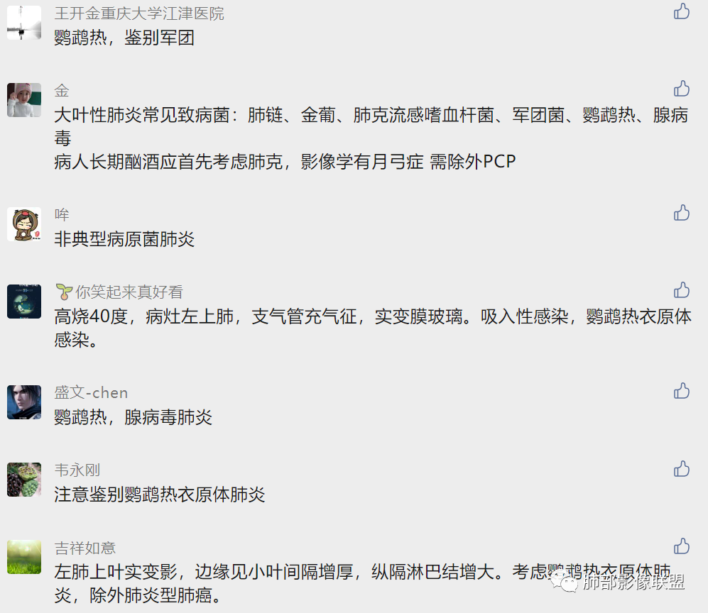 影像PPT - 【病例】鹦鹉热衣原体感染肺炎1例CT-21 影像PPT - 【病例】鹦鹉热衣原体感染肺炎1例CT-21
