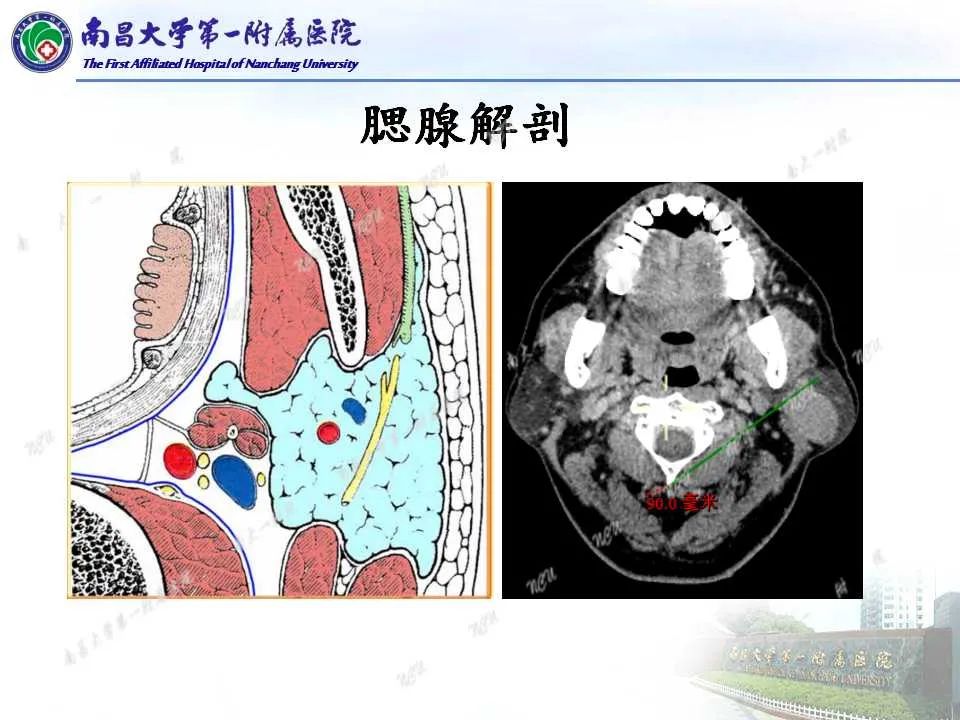 影像PPT - 【PPT】腮腺肿瘤CT诊断分析思路-6