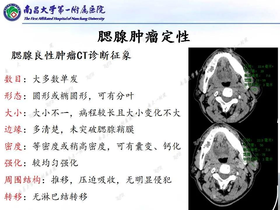 影像PPT - 【PPT】腮腺肿瘤CT诊断分析思路-13