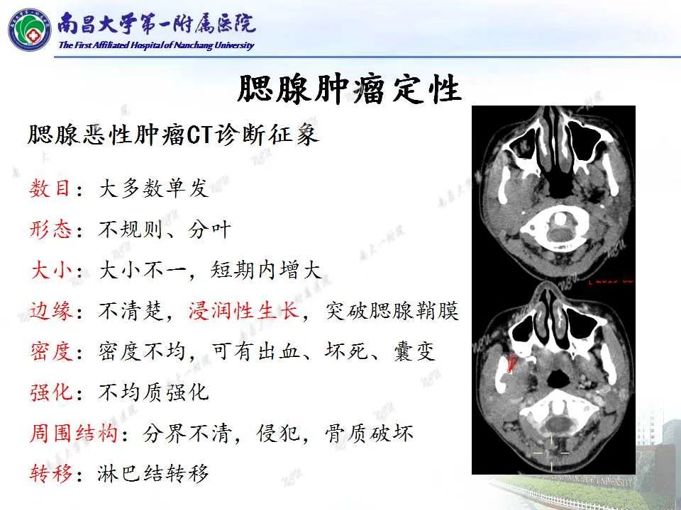 影像PPT - 【PPT】腮腺肿瘤CT诊断分析思路-1