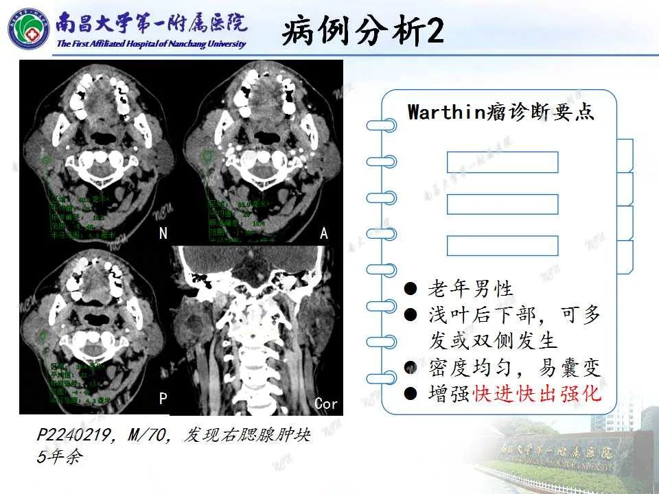 影像PPT - 【PPT】腮腺肿瘤CT诊断分析思路-2