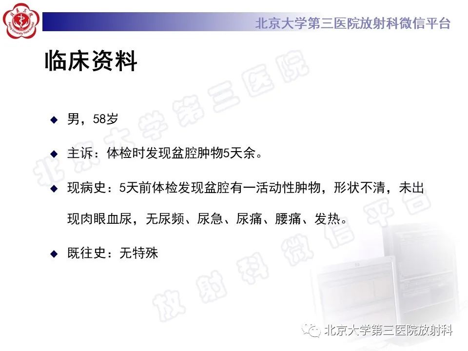 影像PPT - 【PPT】胃肠道间质瘤-2