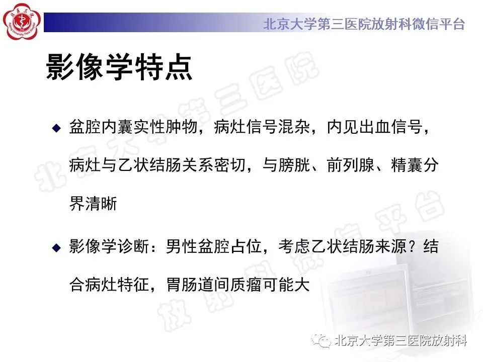 影像PPT - 【PPT】胃肠道间质瘤-10