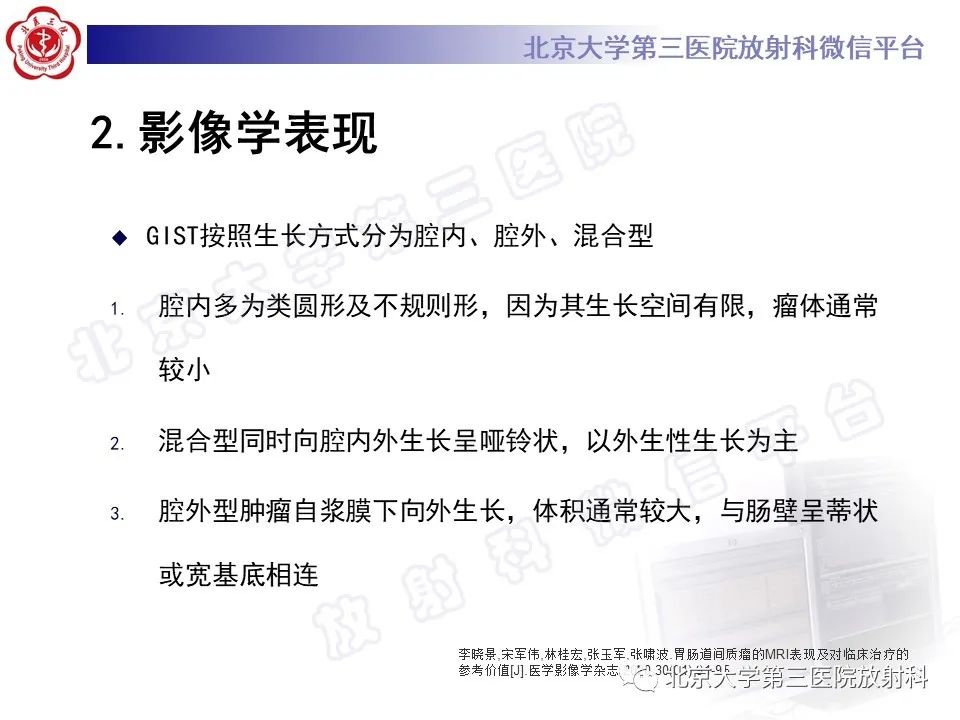 影像PPT - 【PPT】胃肠道间质瘤-15