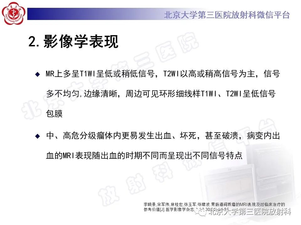 影像PPT - 【PPT】胃肠道间质瘤-17