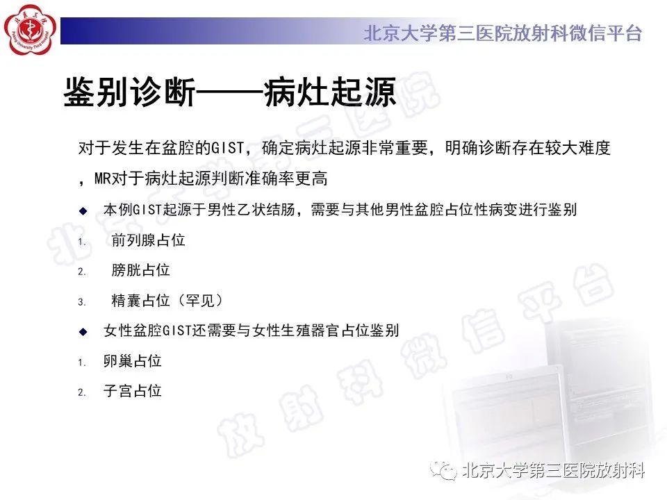 影像PPT - 【PPT】胃肠道间质瘤-22