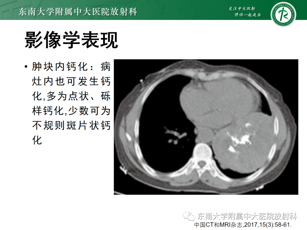 影像PPT - 【PPT】肺硬化性肺细胞瘤-14