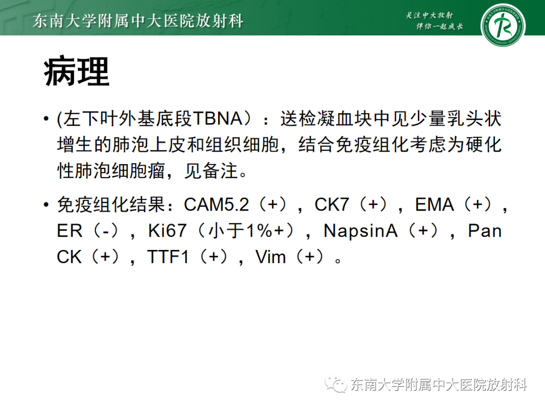 影像PPT - 【PPT】肺硬化性肺细胞瘤-20