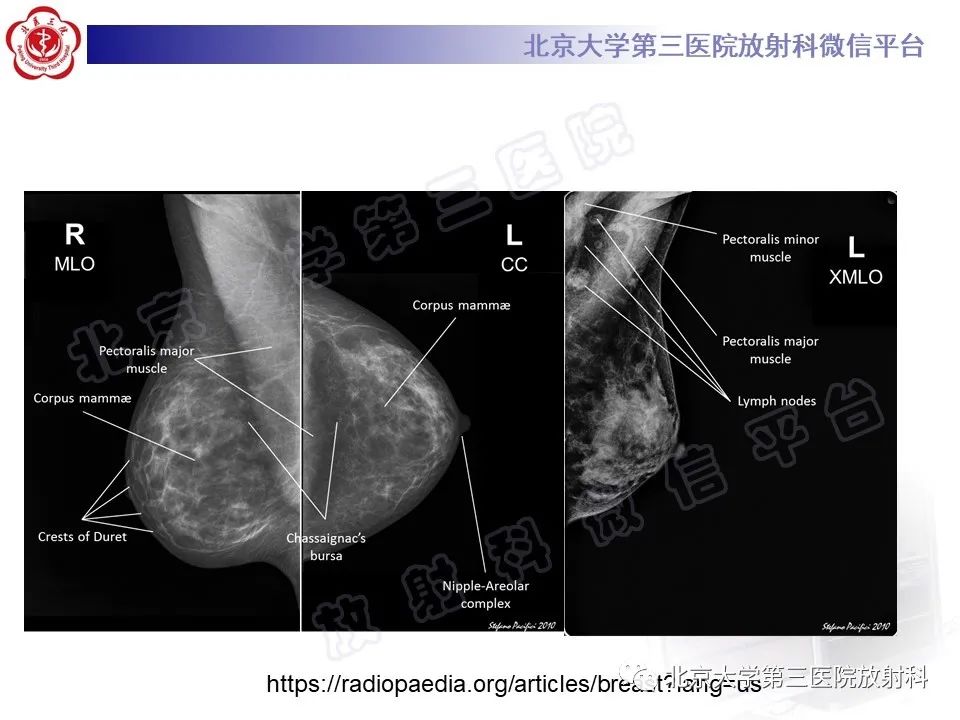 影像PPT - 【PPT】第五版BI-RADS分类解读（乳腺X线摄影）-8