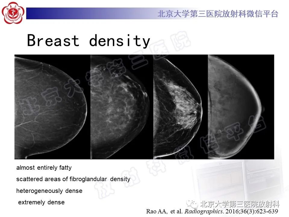 影像PPT - 【PPT】第五版BI-RADS分类解读（乳腺X线摄影）-11