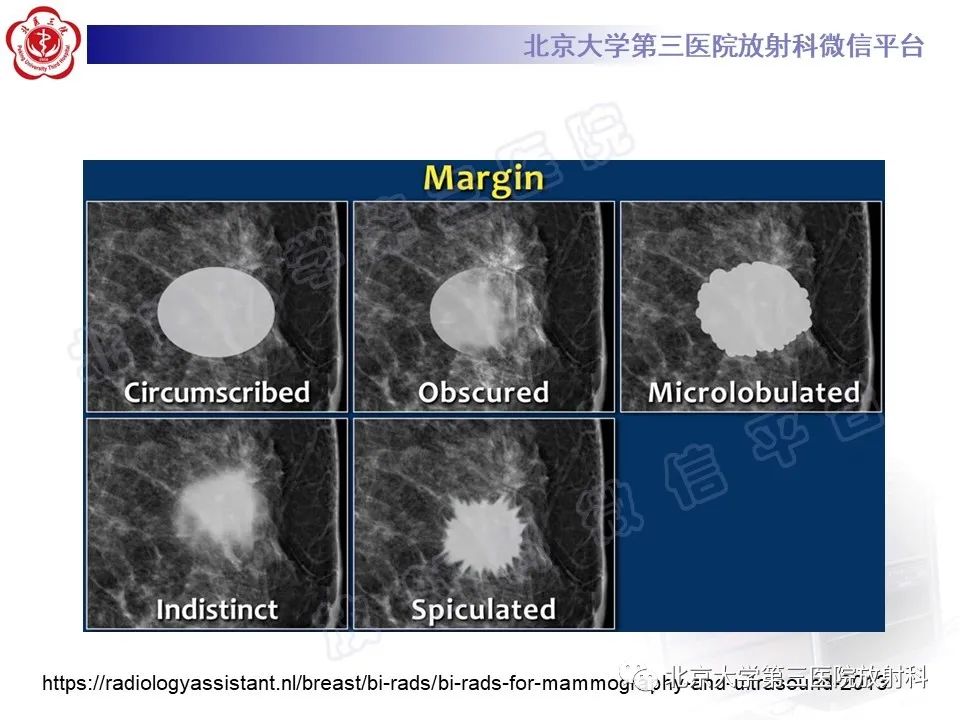 影像PPT - 【PPT】第五版BI-RADS分类解读（乳腺X线摄影）-17