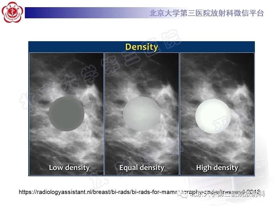 影像PPT - 【PPT】第五版BI-RADS分类解读（乳腺X线摄影）-18