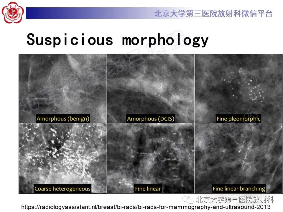 影像PPT - 【PPT】第五版BI-RADS分类解读（乳腺X线摄影）-21