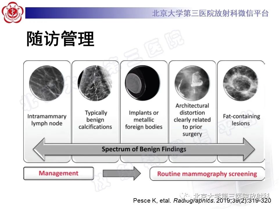影像PPT - 【PPT】第五版BI-RADS分类解读（乳腺X线摄影）-31