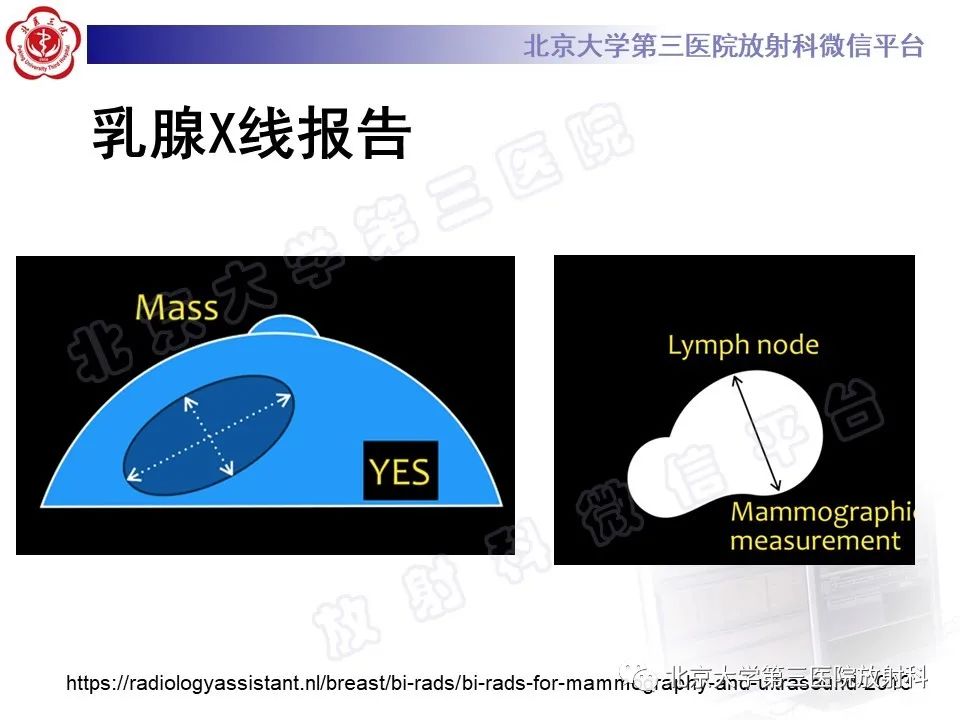 影像PPT - 【PPT】第五版BI-RADS分类解读（乳腺X线摄影）-33
