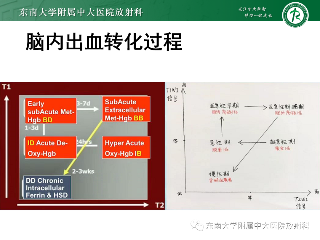 影像PPT - 【PPT】颅内海绵状血管畸形-11