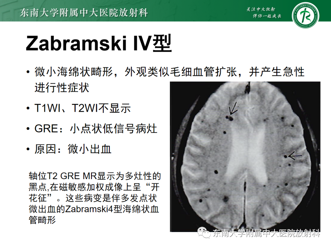 影像PPT - 【PPT】颅内海绵状血管畸形-22
