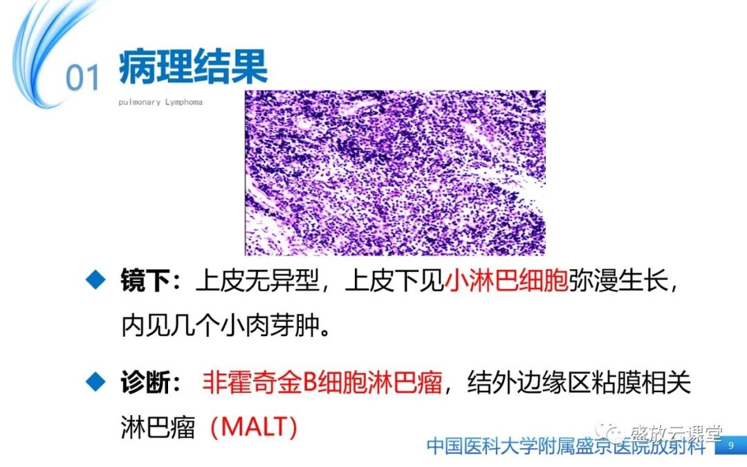 影像PPT - 【病例】肺淋巴瘤1例CT影像-8