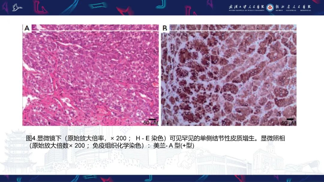 影像PPT - 【PPT】肾上腺常见病变CT及MRI诊断-12